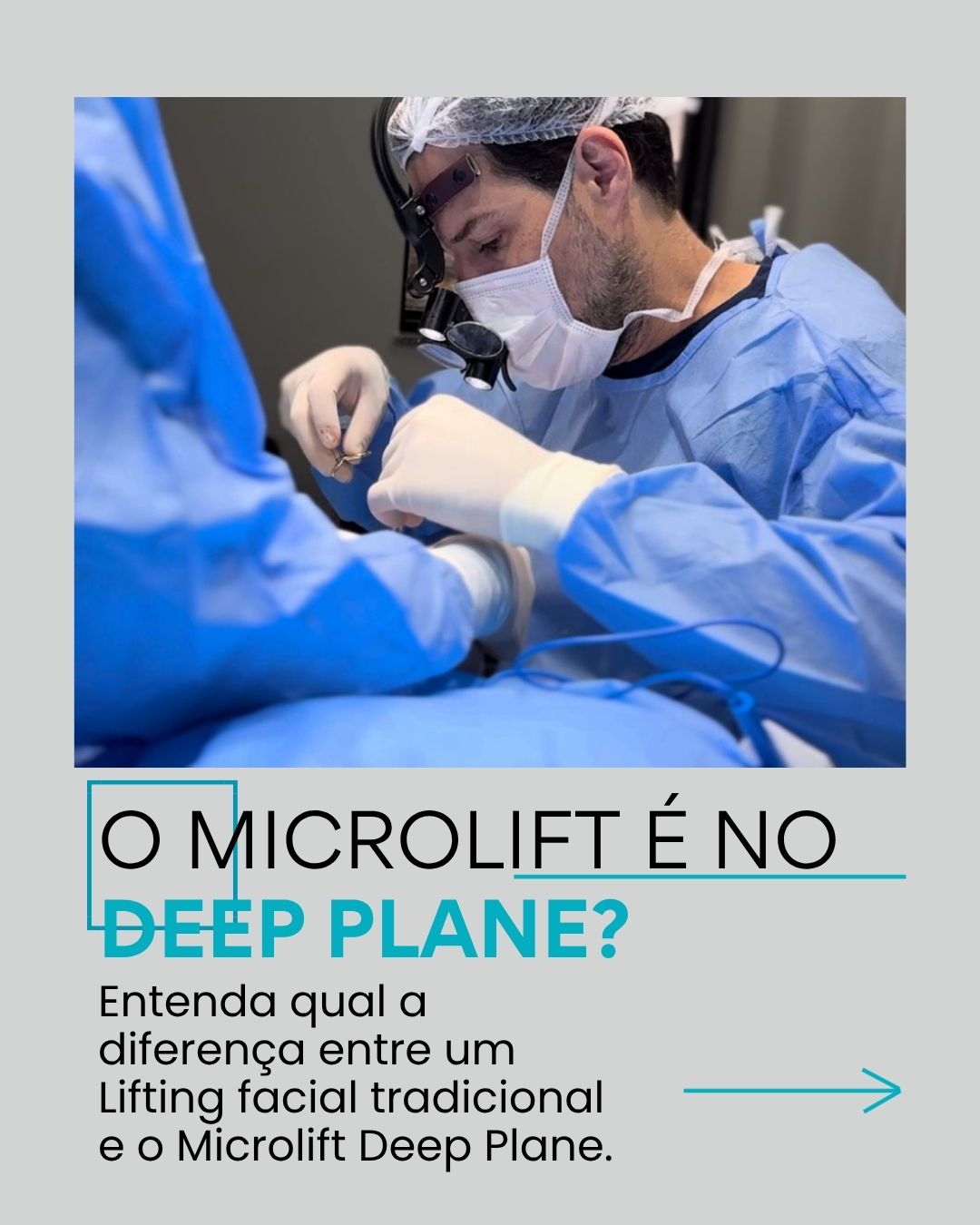 O Microlift é no Deep Plane? Entenda qual a diferença entre um Lifting facial tradicional e o Microlift Deep Plane.